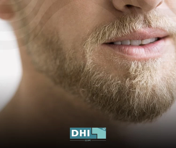 زراعة الذقن قبل وبعد