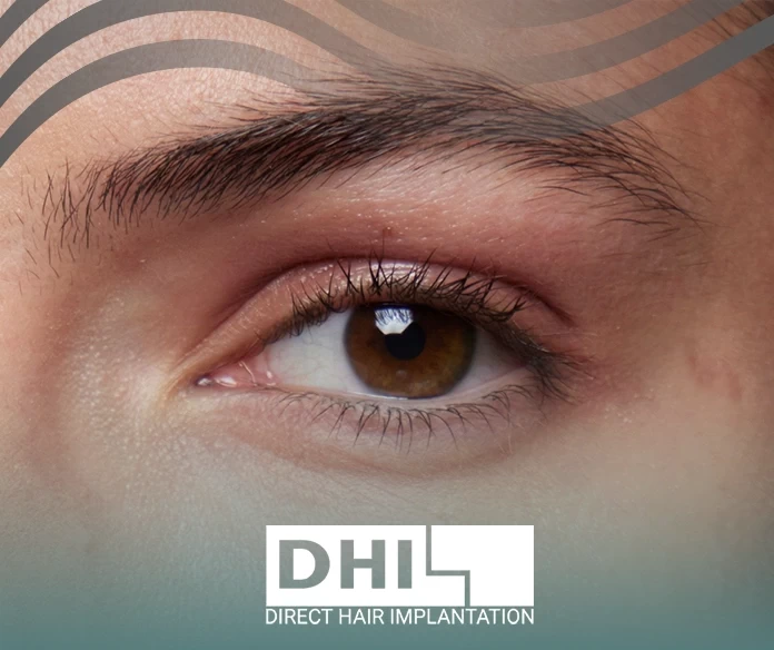 اسباب تساقط شعر الحواجب