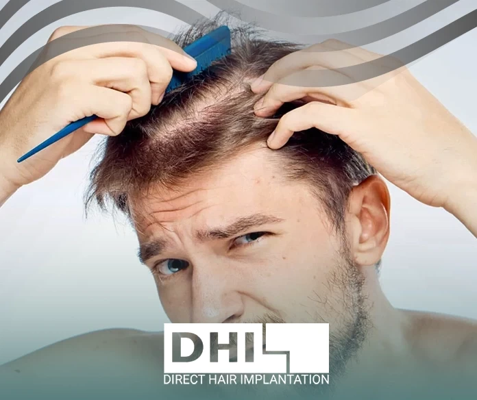 اسباب الصلع عند الرجال