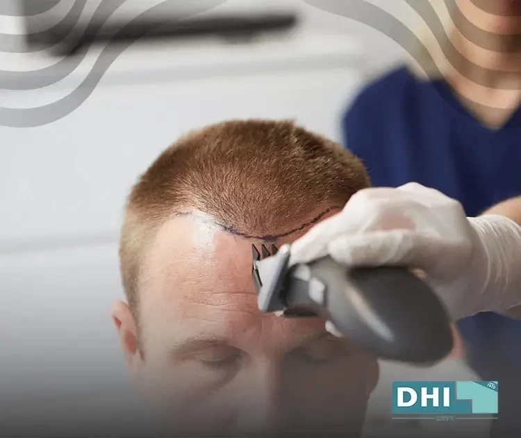 هل زراعة الشعر خطيرة؟