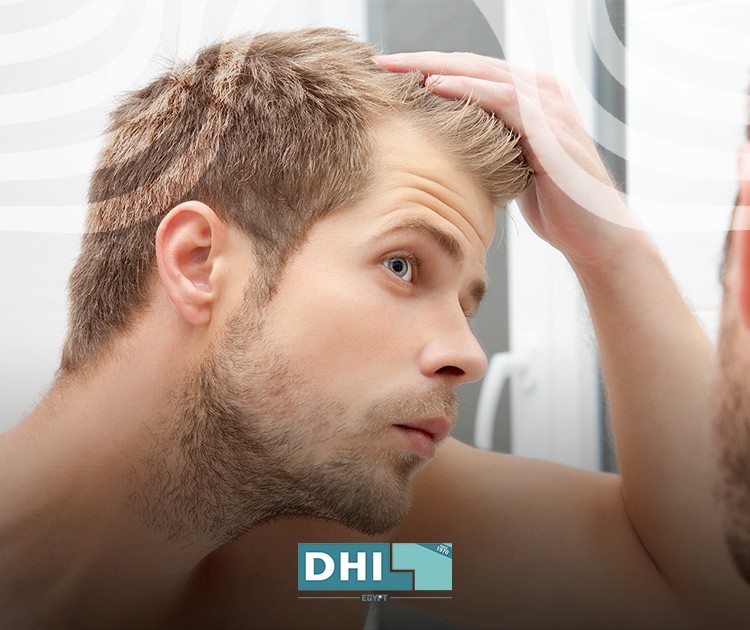 سقوط الشعر بعد الزراعة| هل هو أمر طبيعي؟