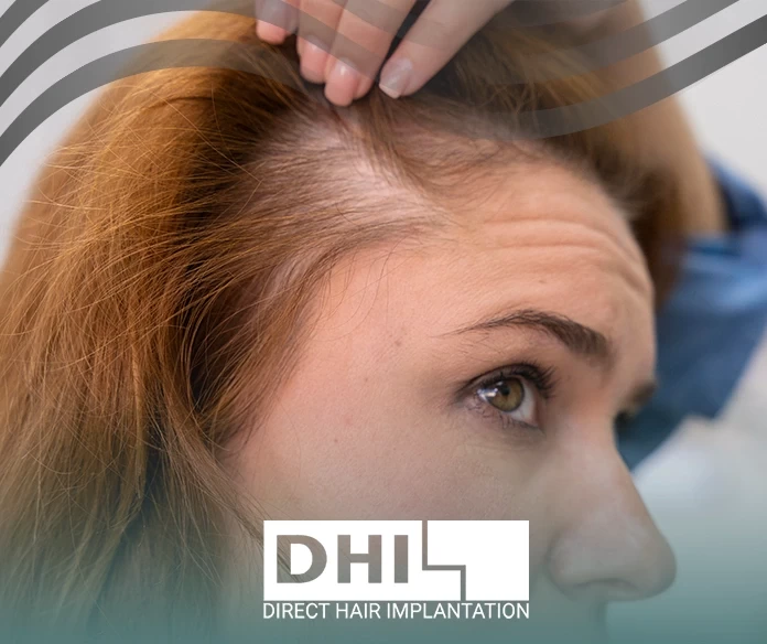 اسباب تساقط الشعر من الجذور