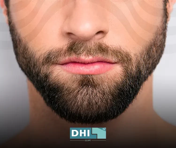 The latest beard hair transplantation techniques