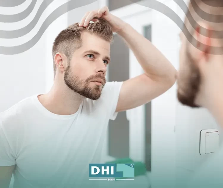 هل يمكن أن يتساقط الشعر المزروع؟