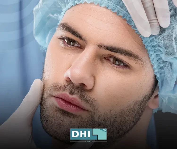 متى تحتاج إلى عملية زراعة ذقن
