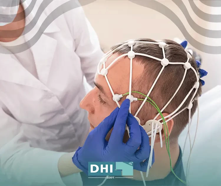 تقنية جديدة لزراعة الشعر