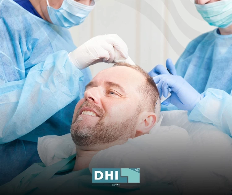 زراعة الشعر للشعر الخفيف