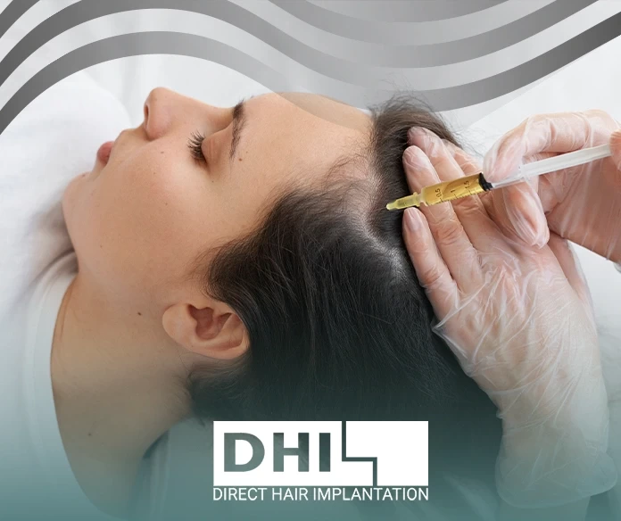 فوائد حقن البلازما للشعر