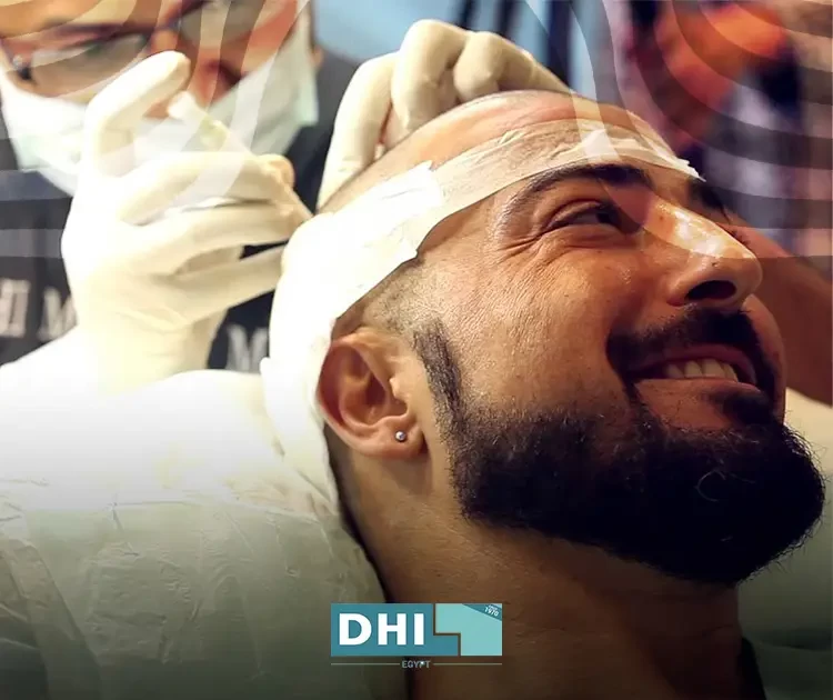 HST hair transplant with stem cell cloning