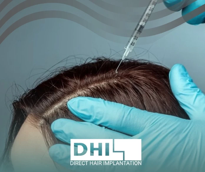 زراعة الشعر بالخلايا الجذعية
