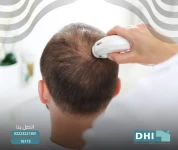 تشخيص تساقط الشعر